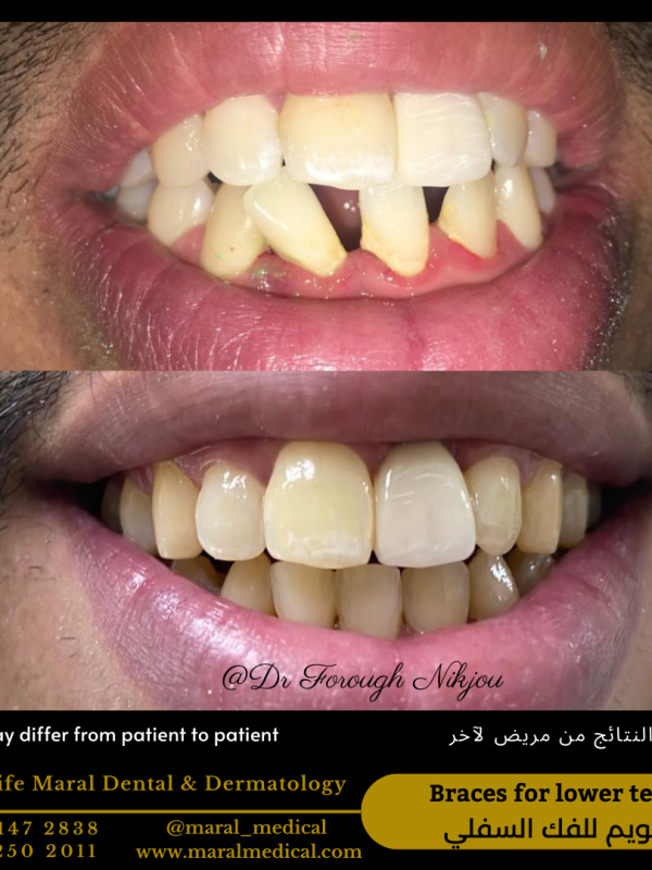 best dentist dubai braces orthodontist dr forough nikjou